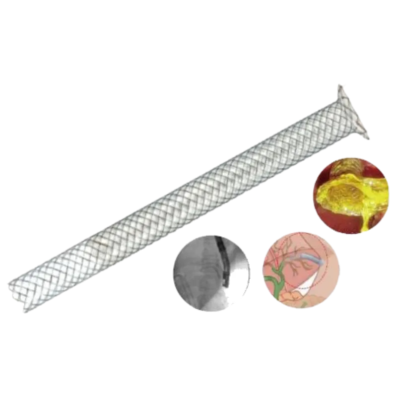 Stent Biliar GIOBOR
