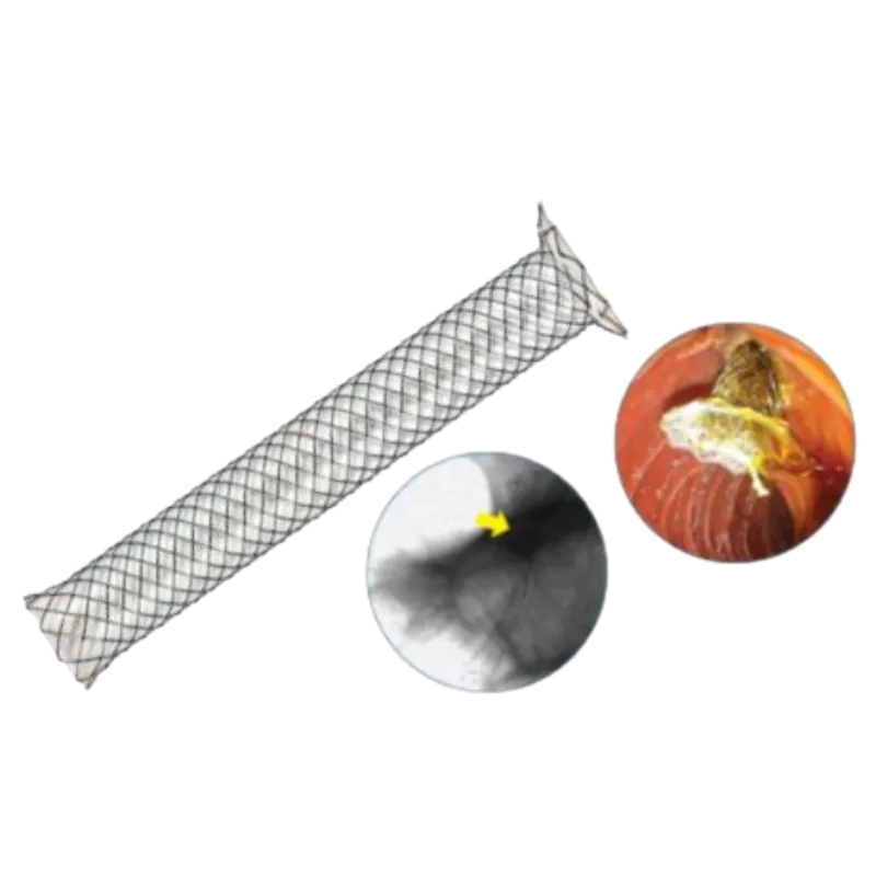 Stent Biliar S Flare (Anti-migração)