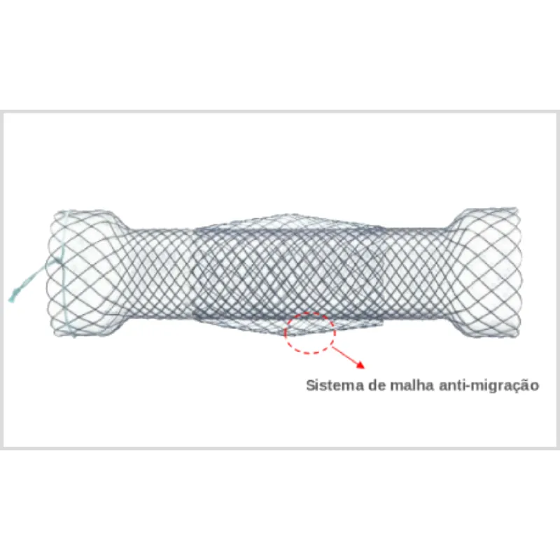 Stent Esofágico DOUBLE (Anti-migração)