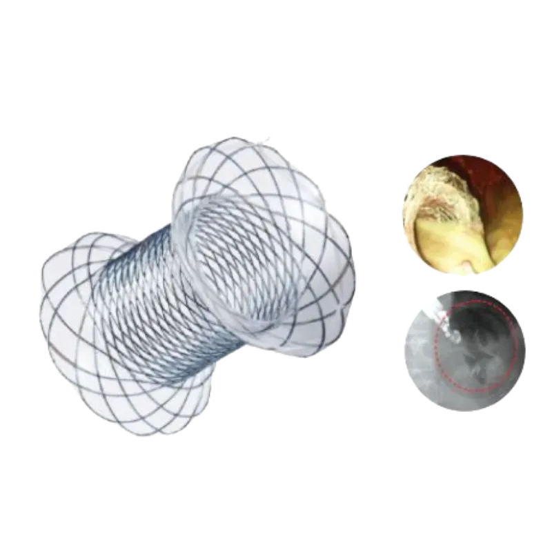 Stent NAGI