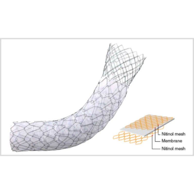 Stent PilóricoDuodenal COMVI (Flare)