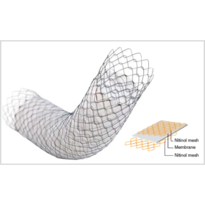 Stent PilóricoDuodenal COMVI