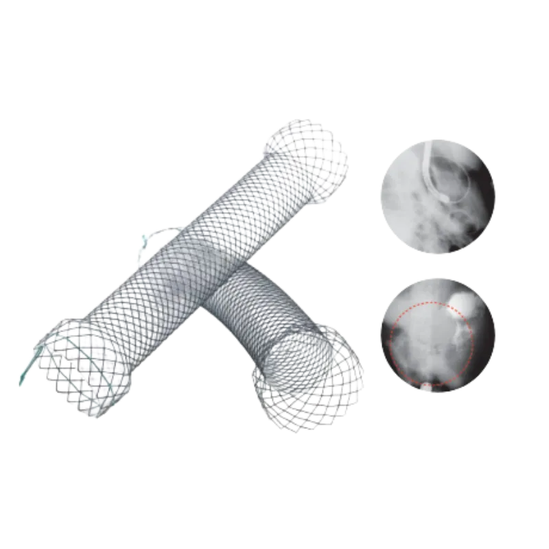 Stent PilóricoDuodenal S